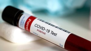 Koronavirüs belirtileri nelerdir?