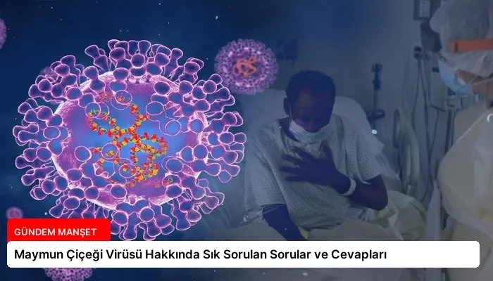 Maymun Çiçeği Virüsü Hakkında Sık Sorulan Sorular ve Cevapları