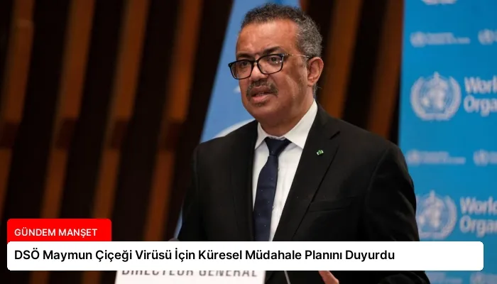 DSÖ Maymun Çiçeği Virüsü İçin Küresel Müdahale Planını Duyurdu